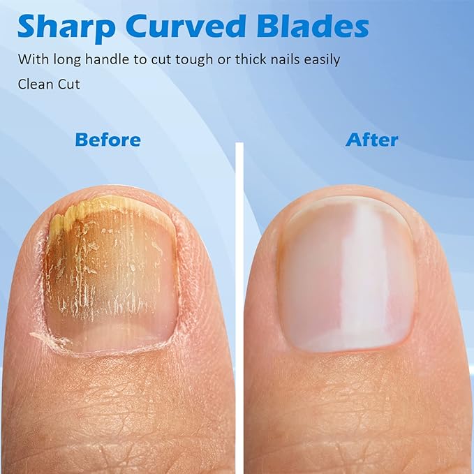 GLAMFIELDS 3pcs Nail Clippers Set, Black Stainless Steel Slanted Edge Nail Clipper & Fingernail & Thick Toenail Trimmer for Men and Women-Mewly Pet