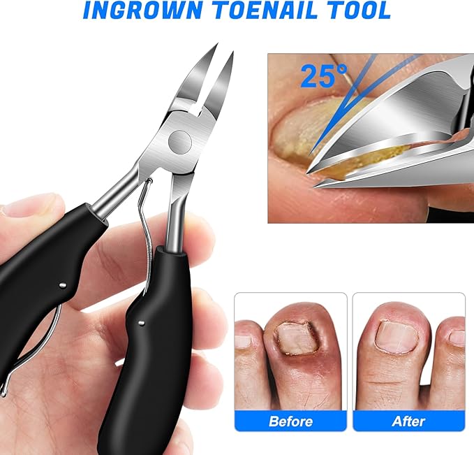 Toenail Clippers for Seniors Ingrown Thick Toenails, 2025 Angled Head Toe Nail Clippers with Catcher, Heavy Duty 45° Slanted Toenail Clippers, 37mm Wide Opening Nail Cutter with Long Handle, 6PCS-Mewly Pet